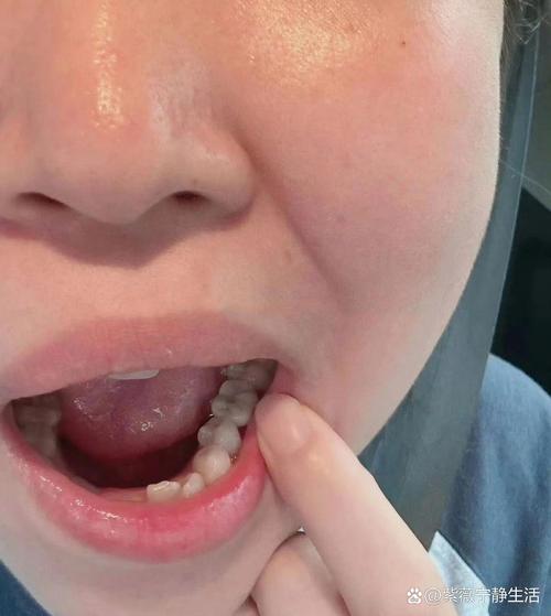 苏州私立种牙-图1