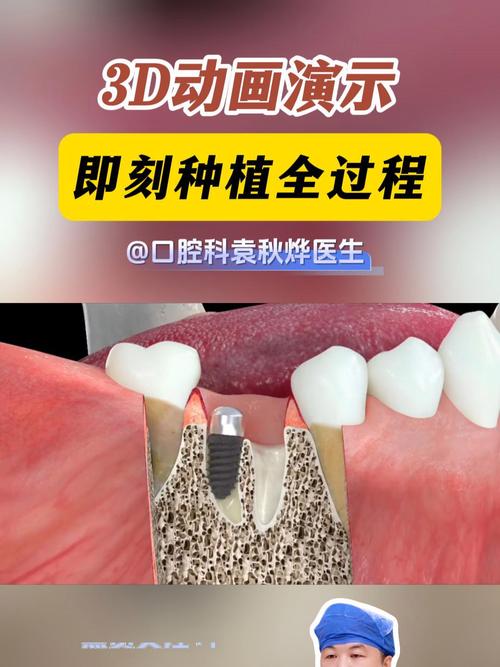 种牙视频感想-图3