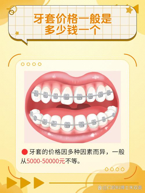 牙缝变大正畸多少钱-图3