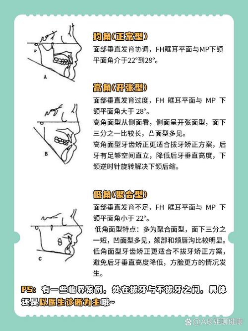 正畸snb角正常值范围具体是多少？-图2