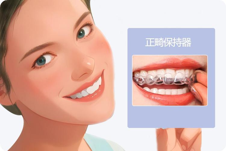 正畸为什么戴保持器-图3