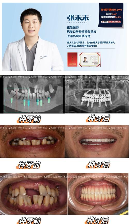 种牙康复案例真实吗？效果能维持多久？-图2