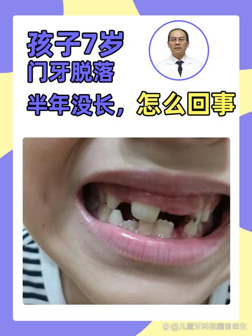 牙根短正畸，牙齿会脱落吗？-图2