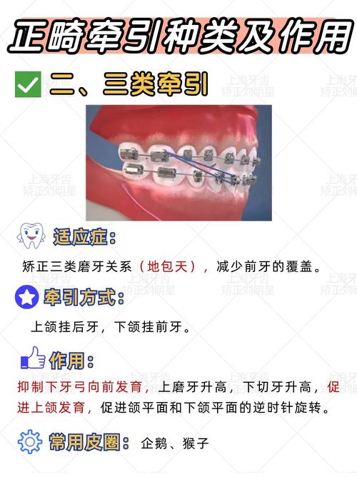 正畸治疗中颊面管的数量有标准吗？一般需要几个？-图2