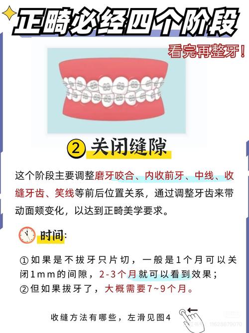 口腔正畸几岁比较好-图3