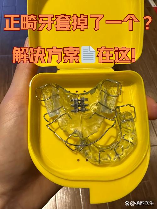 正畸复诊清理牙套吗-图2