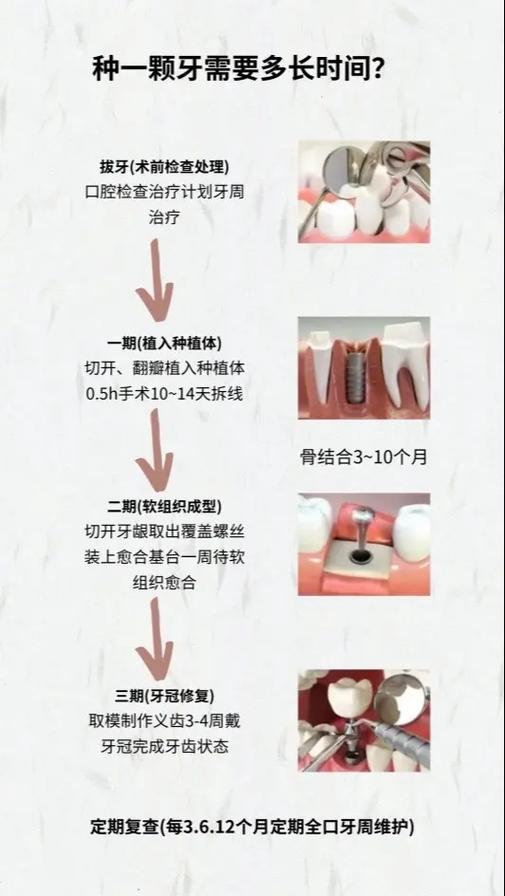 江苏哪里种牙-图2