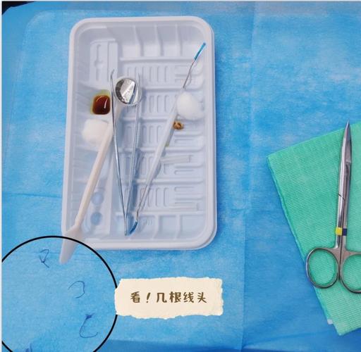 种牙后拆线时间、疼痛及护理注意事项有哪些？-图2