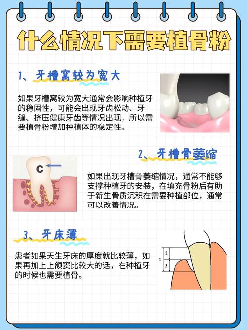 正畸前需要植骨粉吗-图2