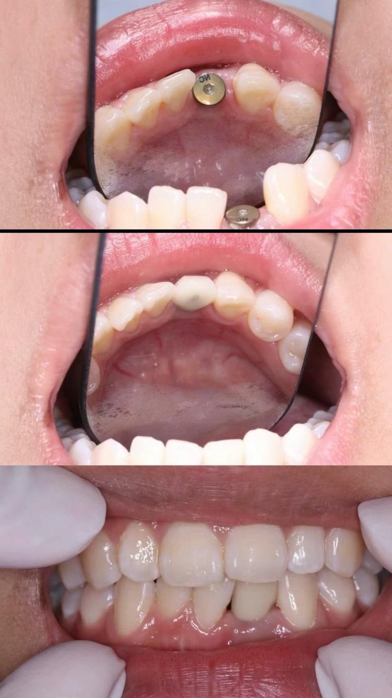 种牙那里做好-图3