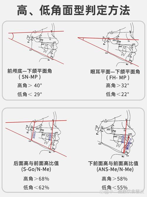 正畸anb角的正常值范围是多少?-图2 正畸anb角的正常值范围是多少?-图2