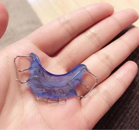 双杆式口外正畸牵引-图2