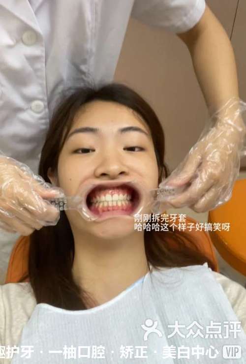 牙很齐牙缝大做正畸-图3