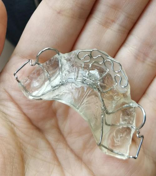 正畸螺旋缩弓器矫治-图3