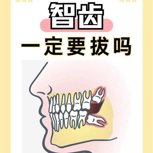 不正畸还要拔智齿吗-图1