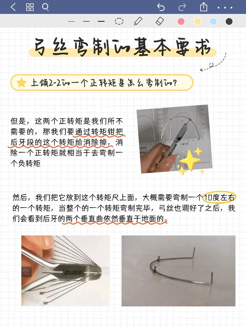 正畸弓丝怎么移动的-图1 正畸弓丝怎么移动的-图1