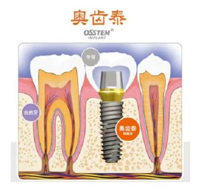 德国种牙寿命-图1