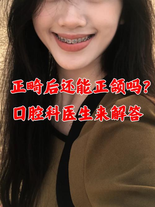 做过正畸还能正颌吗-图1