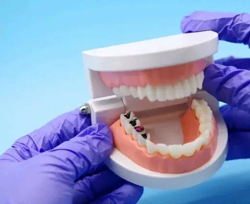 山东种牙水平-图3