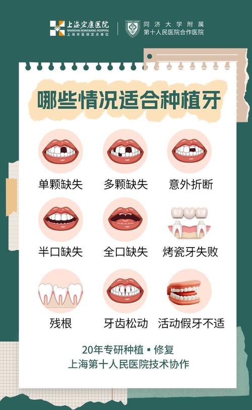 种牙可以选择-图3 种牙可以选择-图3