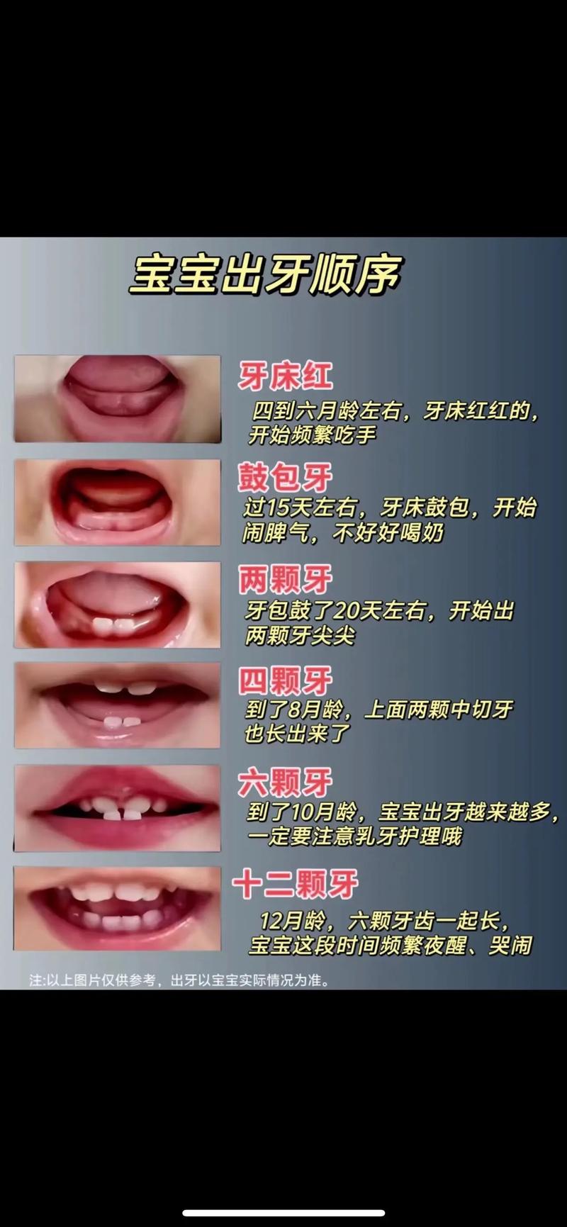 儿童种牙有必要吗？家长必知的适应症、时机及重要性-图3