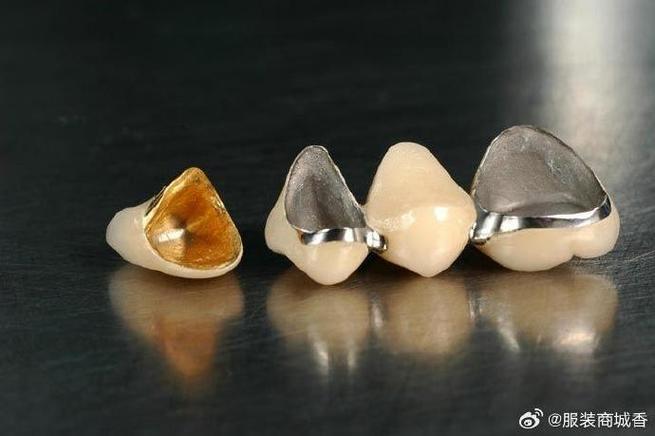 种牙金属牙冠-图2