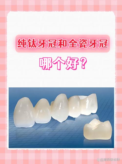 种牙金属牙冠-图1