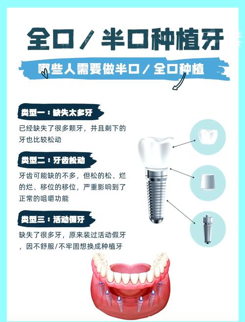 种牙有哪些必知知识？新手必看指南与解答-图2