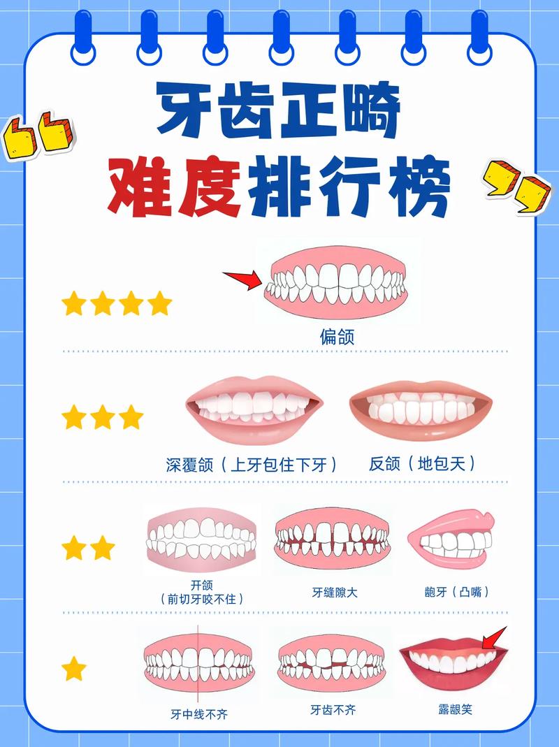 正畸中的难度费是什么？为何不同病例收费差异大？-图2