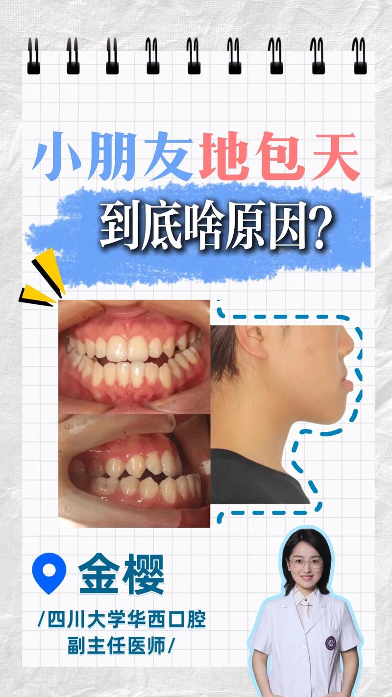 口腔正畸有没有必要-图2