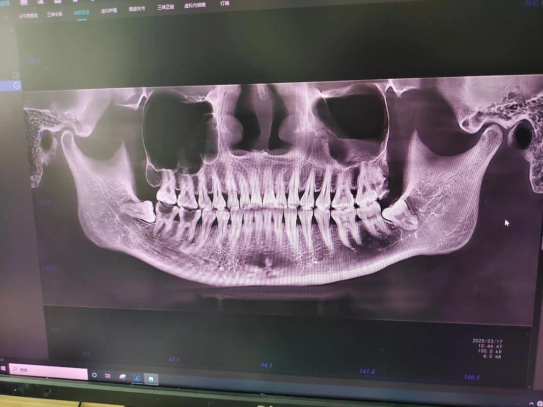 正畸影像技术平行线-图1