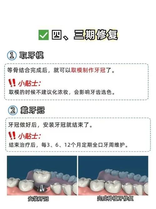 种牙所需时间-图3