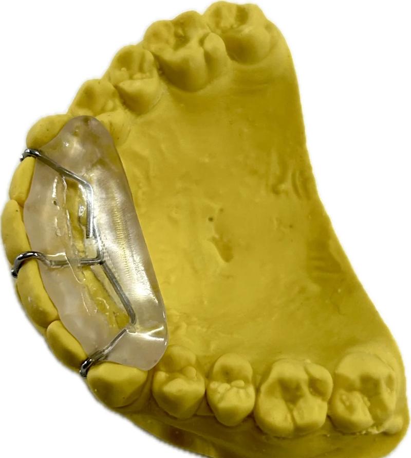 正畸平导的做法视频-图1