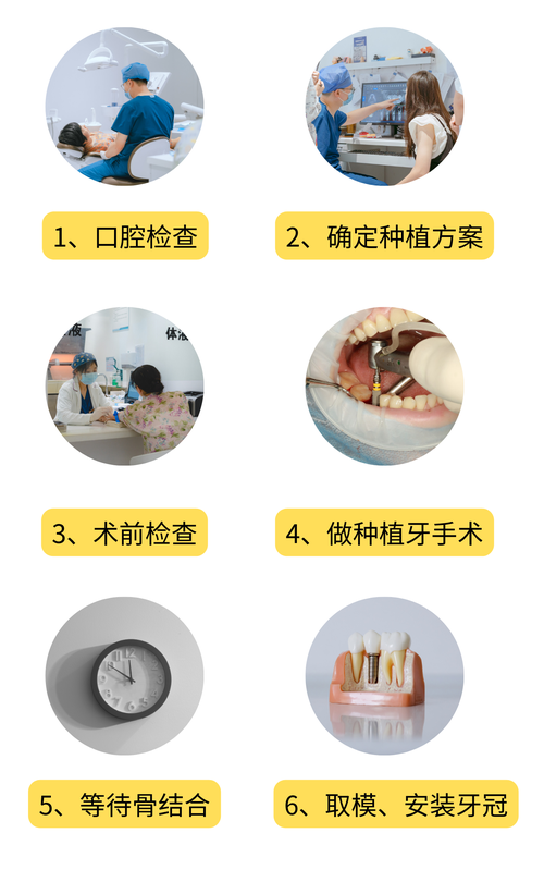 种牙前期准备-图1 种牙前期准备-图1
