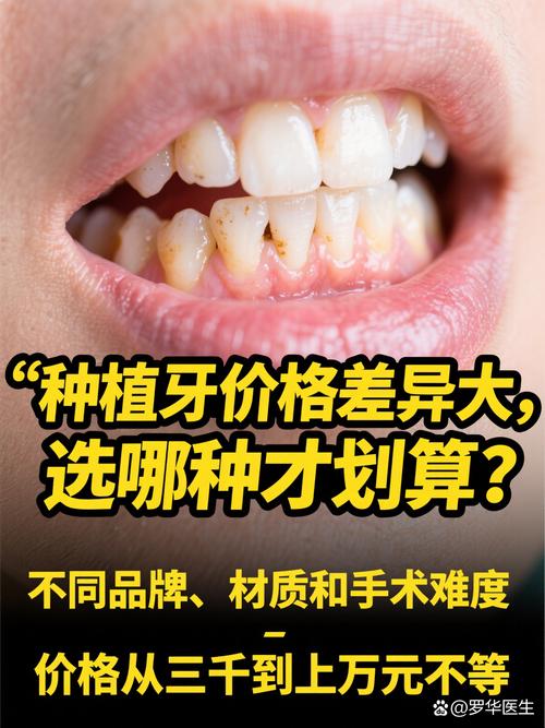 去哪儿种牙好-图2