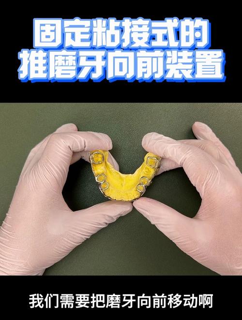 正畸常用的粘接技术-图2