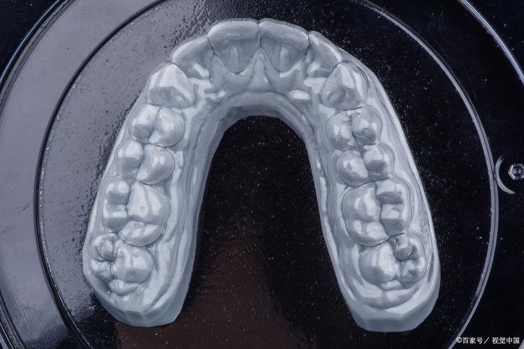 柯帝夫正畸陶瓷托槽-图2