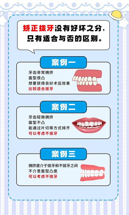 正畸拔牙都是拔哪颗-图3