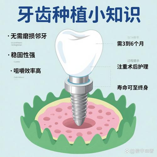 磨牙种牙方案-图3