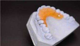 正畸斜面导板制作需掌握哪些核心技巧？-图1