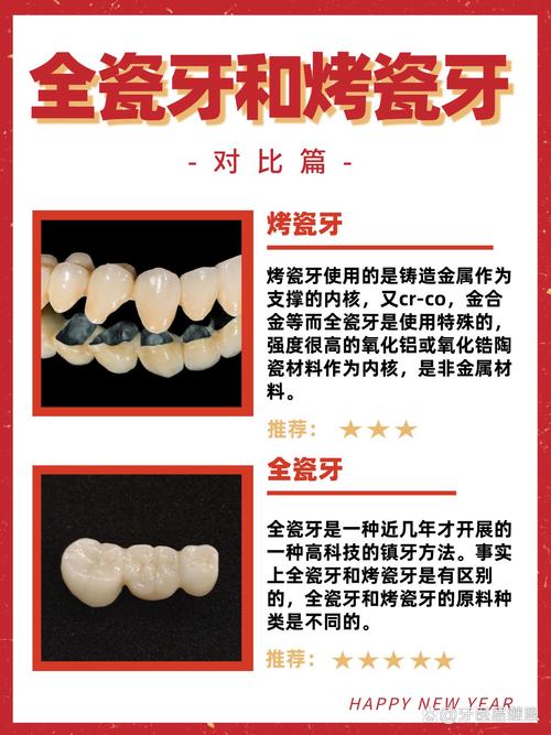 全瓷牙与种牙有何区别？缺牙修复该如何正确选择？-图3