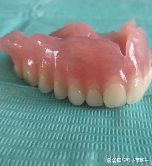 80岁可种牙-图3