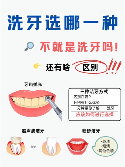 洗牙有多少种-图3
