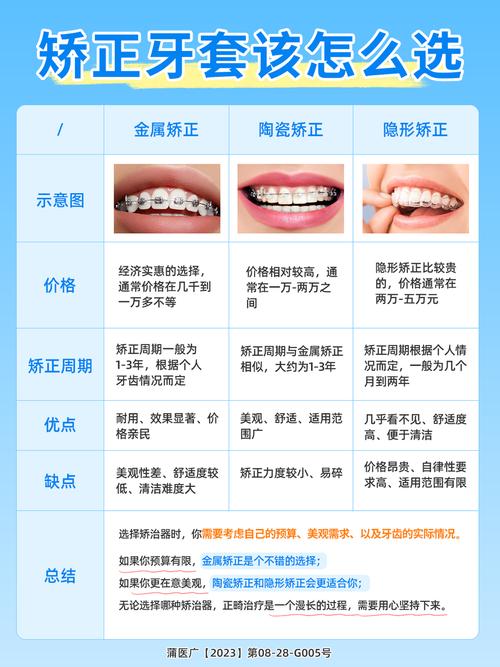 牙套有多少种-图2