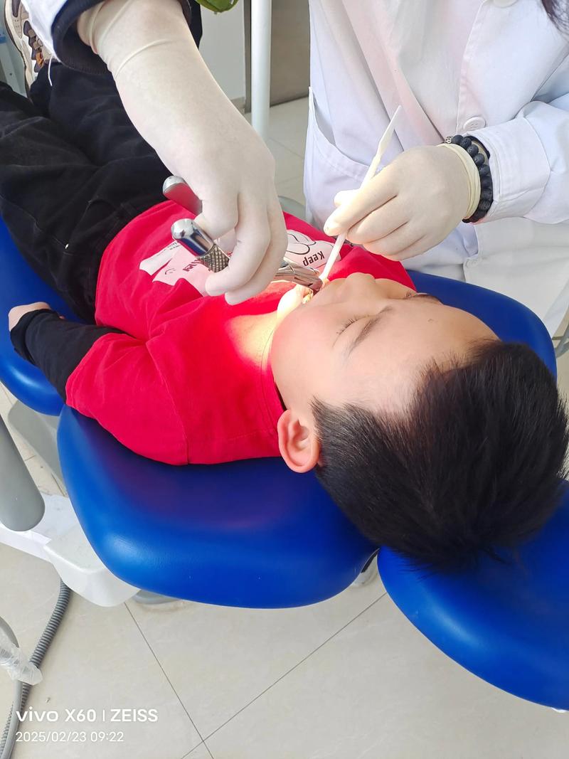 儿童6龄齿拔除正畸-图1