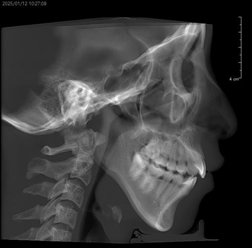 关节有问题能正畸么-图3 关节有问题能正畸么-图3