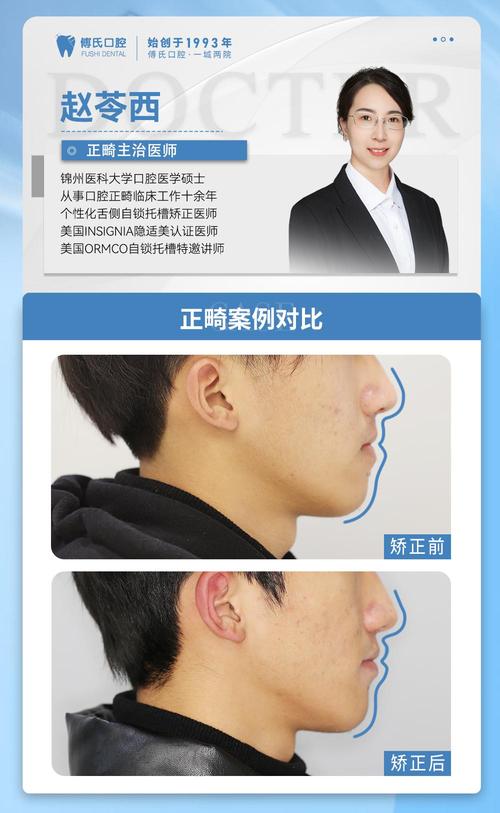 地包天看口腔正畸科-图2