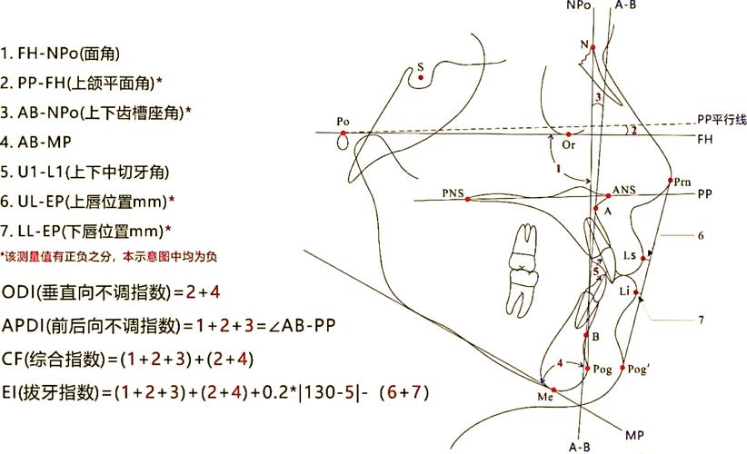 正畸头影测量合凸角-图3