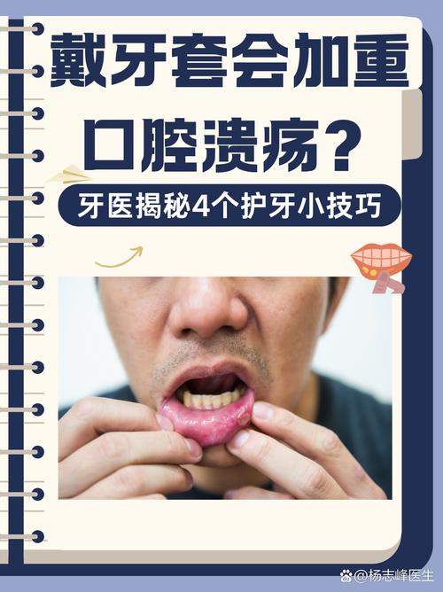 牙齿正畸期间口腔溃疡频发,该如何有效应对?-图1 牙齿正畸期间口腔溃疡频发,该如何有效应对?-图1