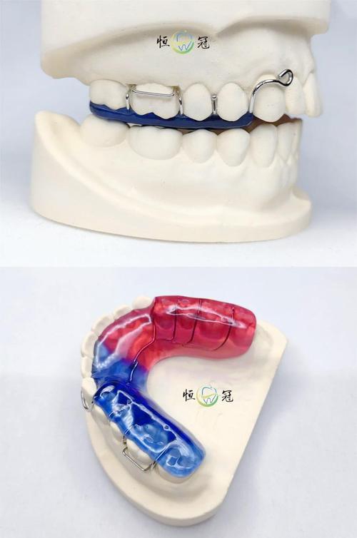 正畸牙齿平导的图片-图2